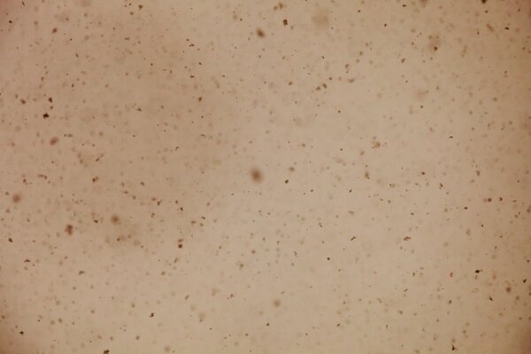 Black dots on a beige background